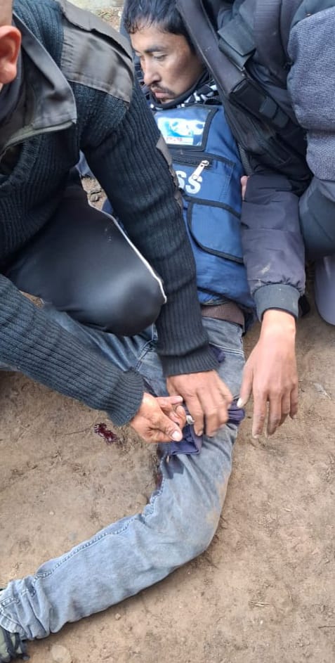 गोलीबारी में घायल हुए पत्रकार को पैर में गोली लगी। उसे इंफाल वेस्ट के राज मेडिसिटी अस्पताल पहुंचाया गया।