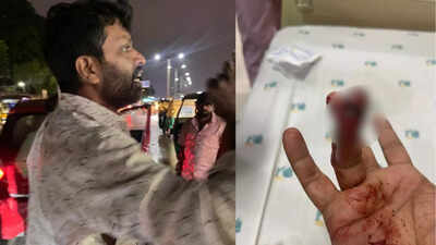Bengaluru road rage: Man bites businessman's finger, surgery costs Rs 2 lakh